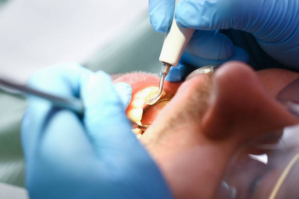 Best Mobile Emergency Dentist in Boalsburg, PA